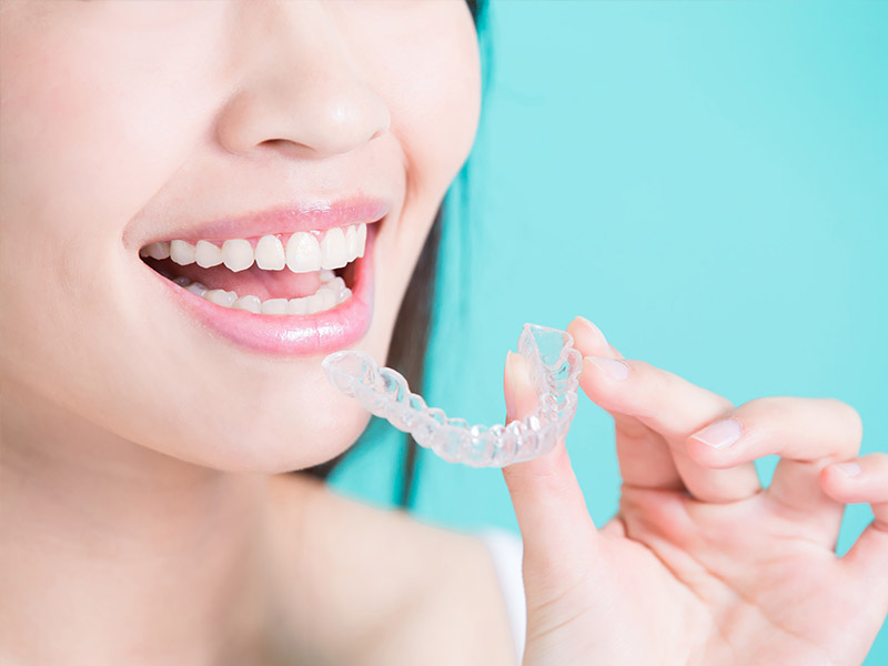 invisalign in grande prairie