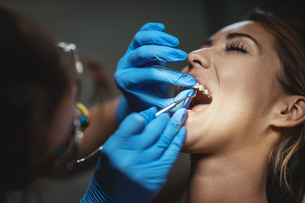things you should know before you get teeth bonding