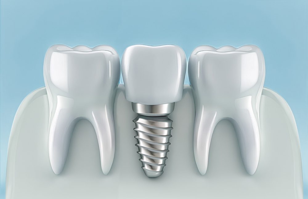 dental implants vs dentures which option is right for you