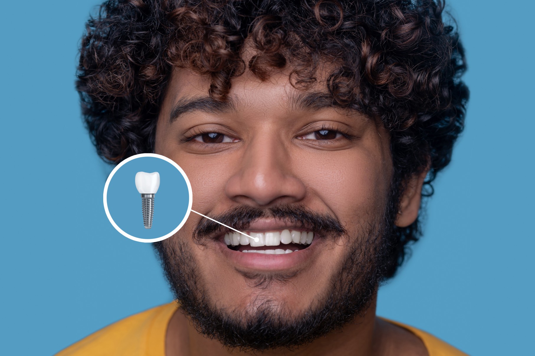 What is the Process for Getting Dental Implants